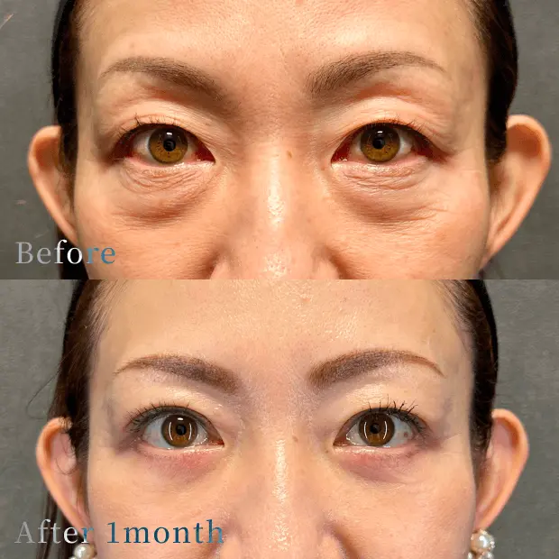 ビフォーアフター写真