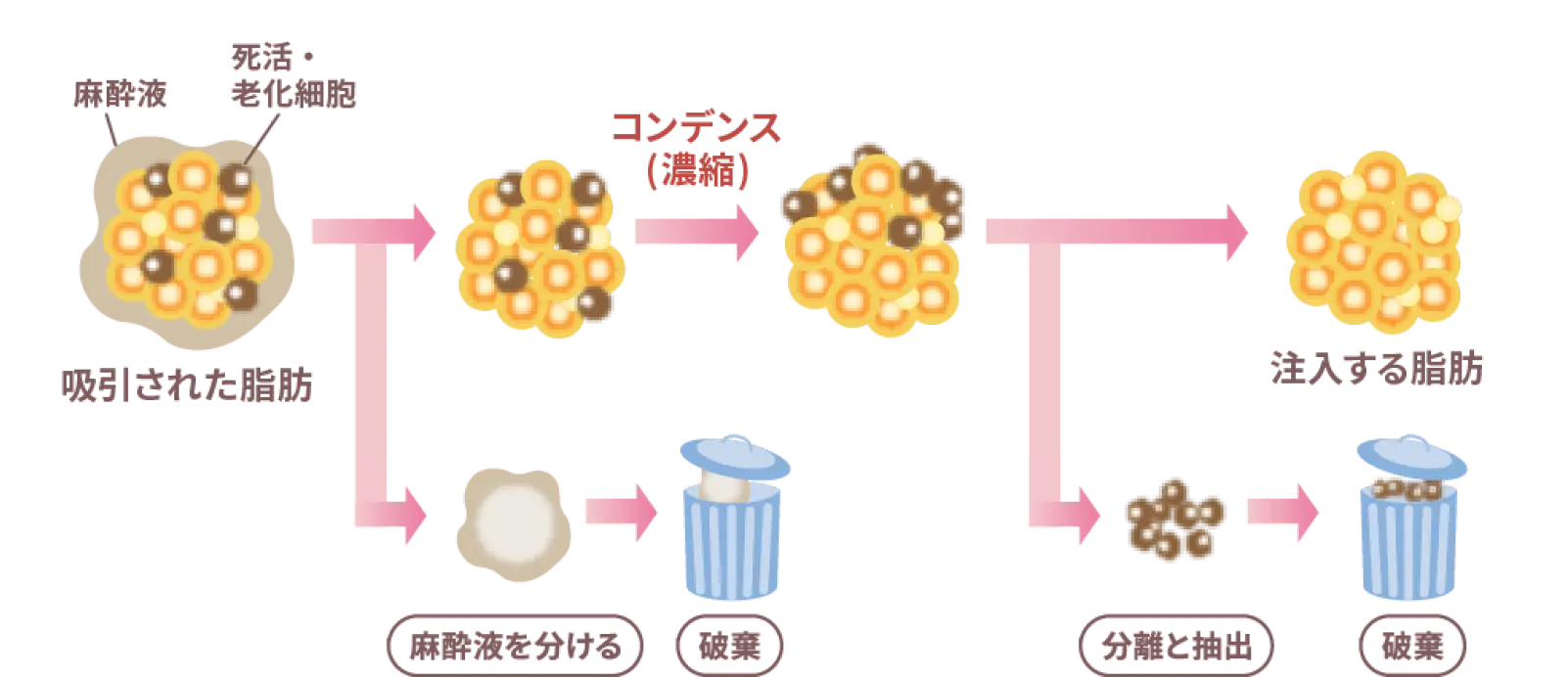 コンデンスリッチ法